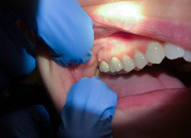 Best Mobile Emergency Dentist in Bangor Base, WA